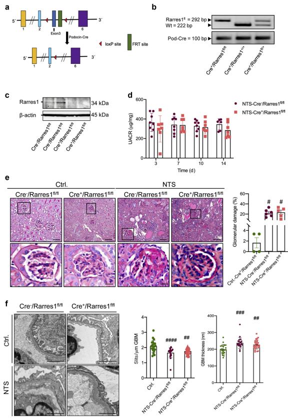 glomerular diseases glomerular diseases
