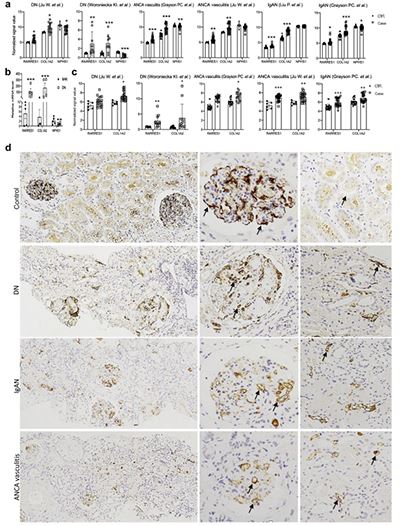 Retinoic Acid Retinoic Acid