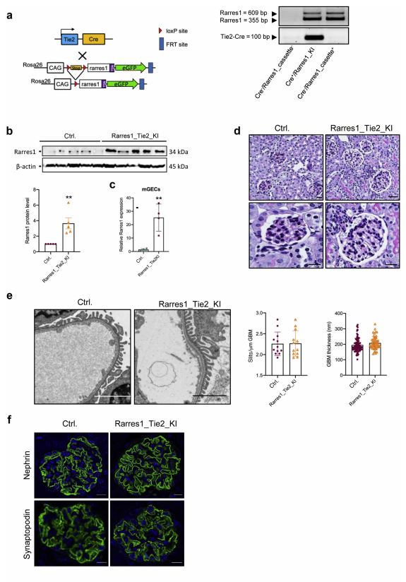 glomerular diseases glomerular diseases