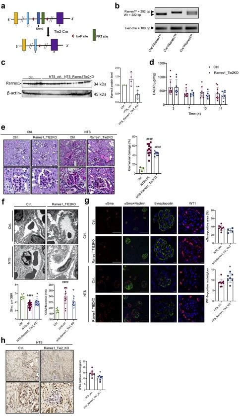Glomerular Diseases Glomerular Diseases