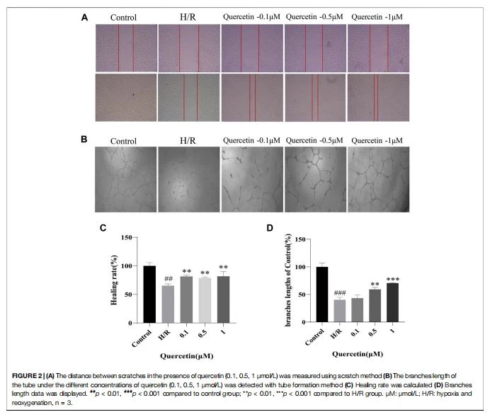  (A) The distance between scratches in the presence of quercetin (0.1, 0.5, 1 μmol/L) was measured using scratch method (B) The branches length of the tube under the different concentrations of quercetin (0.1, 0.5, 1 μmol/L) was detected with tube formation method (C) Healing rate was calculated (D) Branches length data was displayed. ##p < 0.01, ###p < 0.001 compared to control group; **p < 0.01, ***p < 0.001 compared to H/R group. μM: μmol/L; H/R: hypoxia and reoxygenation, n  3.