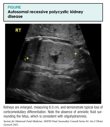 where to buy cistanche