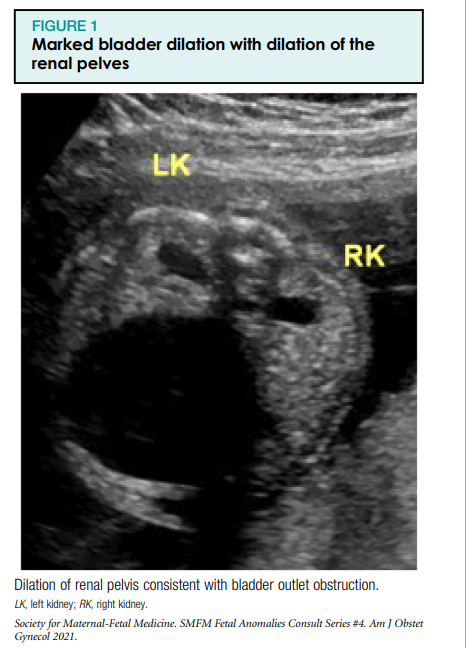 cistanche south africa